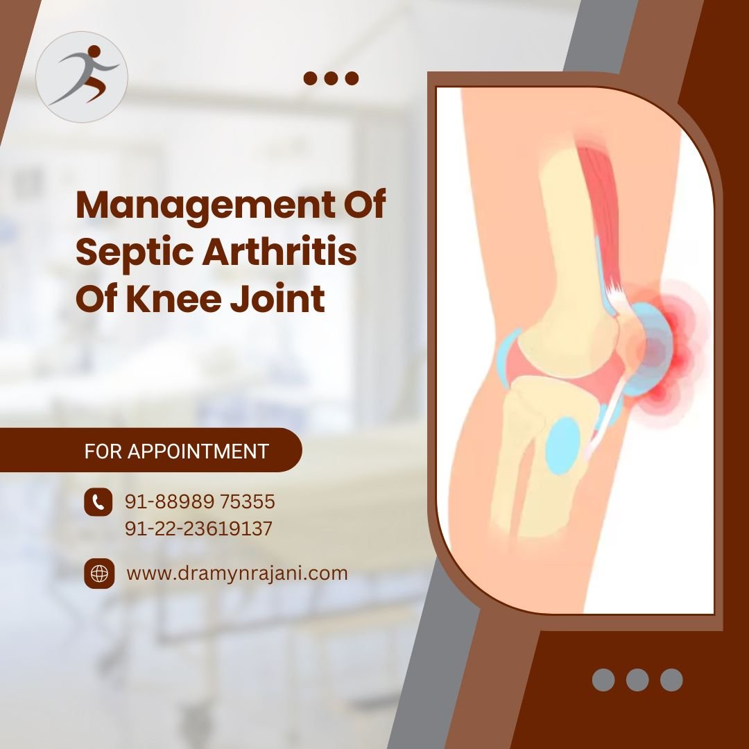 Management Of Septic Arthritis Of Knee Joint