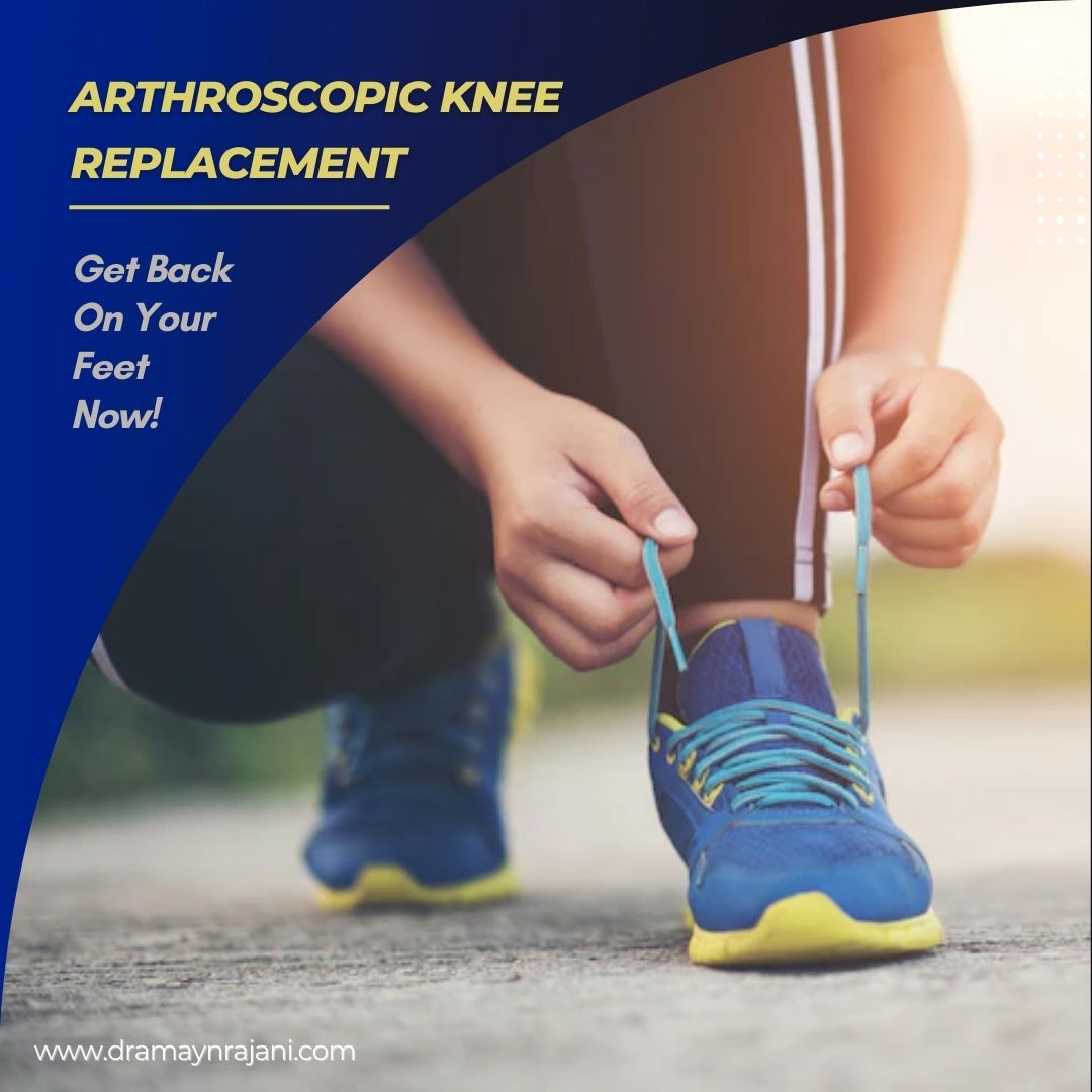 Arthroscopic Knee Replacement - Get Back On Your Feet Now