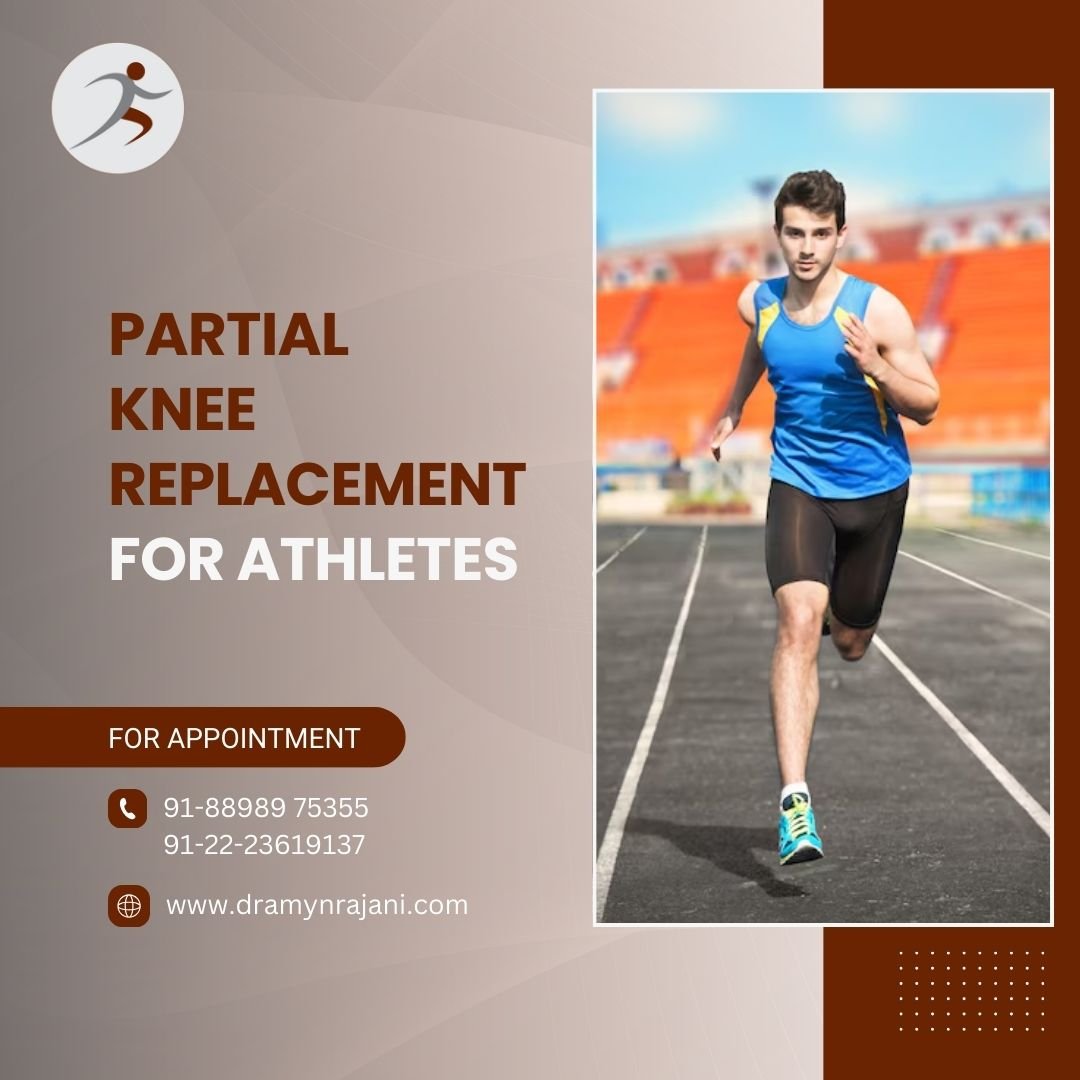 Partial Knee Replacement for Athletes