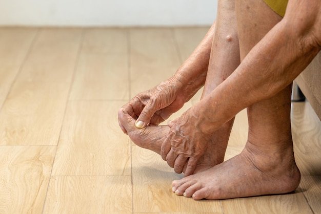 Photo elderly woman massage her foot with painful swollen gout inflammation