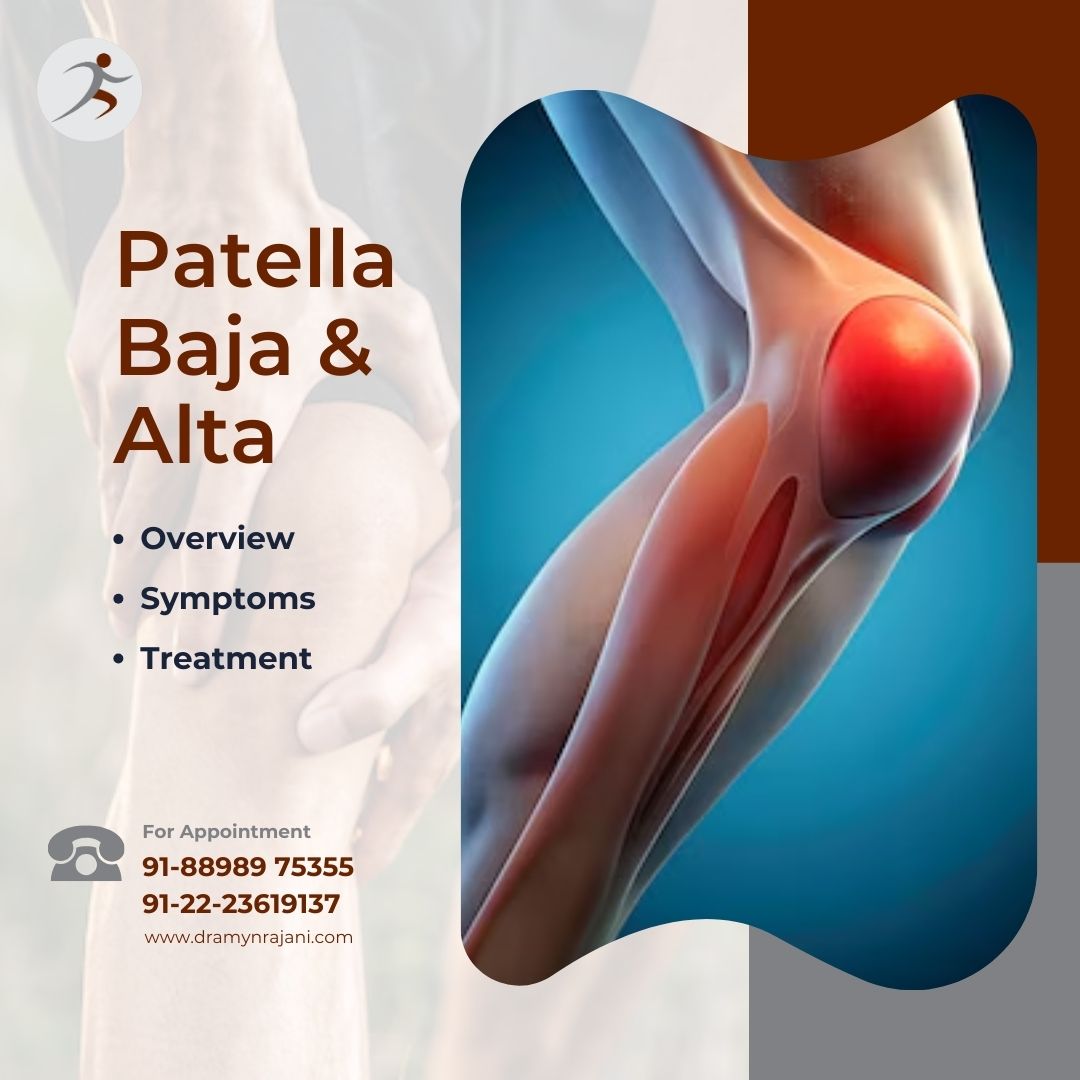 Patella Baja & Alta - Overview, Symptoms & Treatment