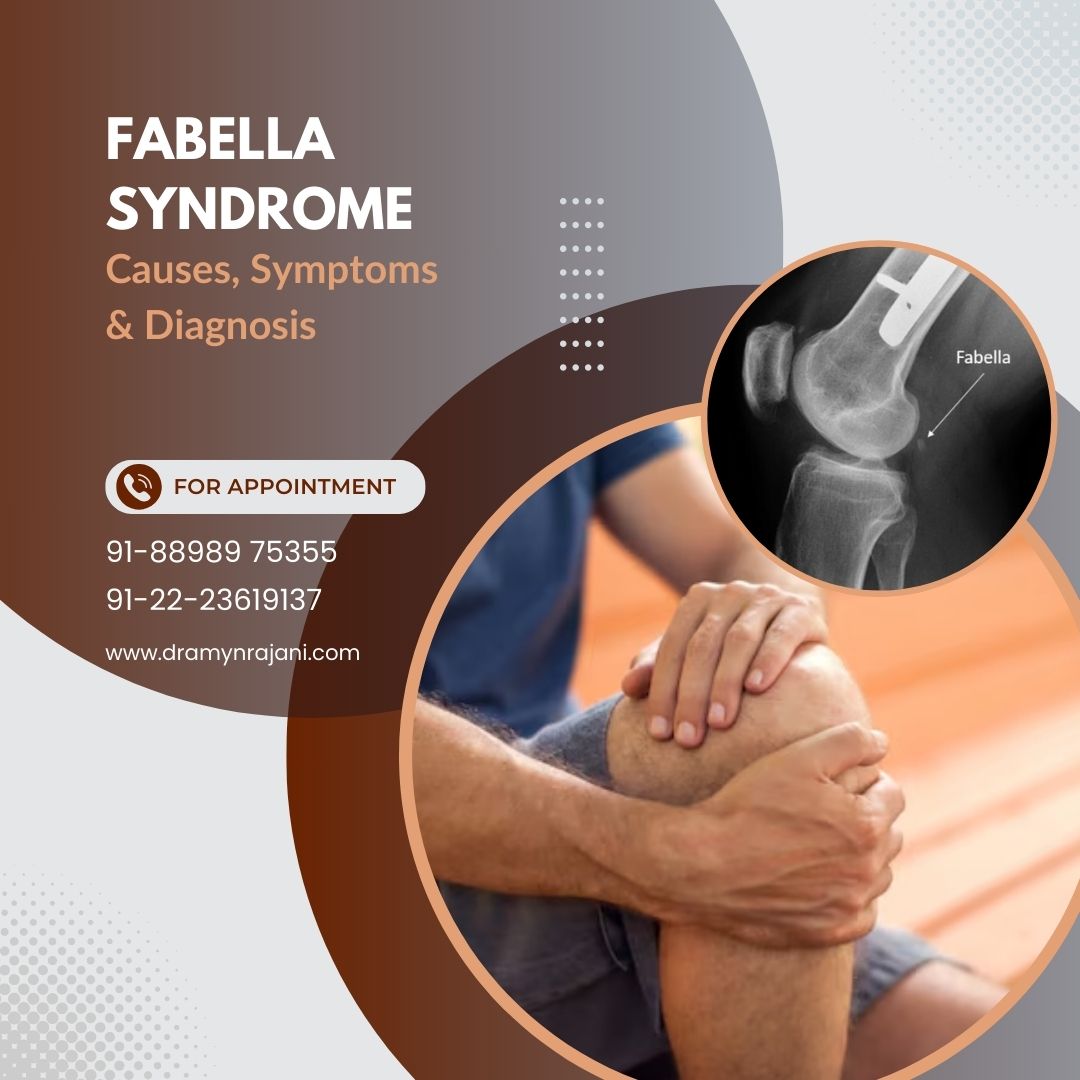 Fabella Syndrome - Causes, Symptoms & Diagnosis