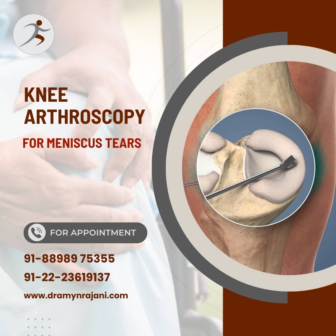 Knee Arthroscopy for Meniscus Tears