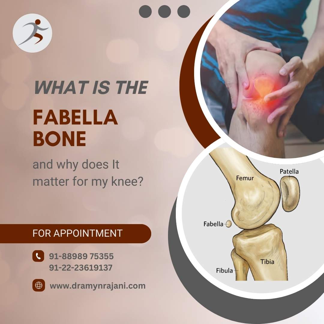 What is the Fabella Bone and Why Does It Matter for My Knee