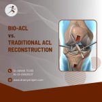 Bio-ACL vs. Traditional ACL Reconstruction