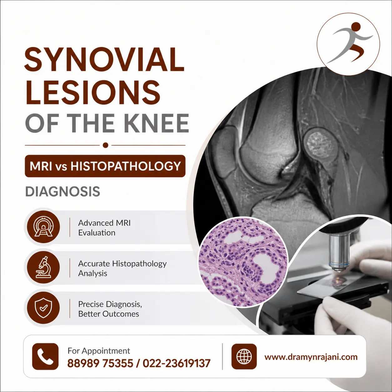 Synovial Lesions of the Knee – MRI vs Histopathology Diagnosis