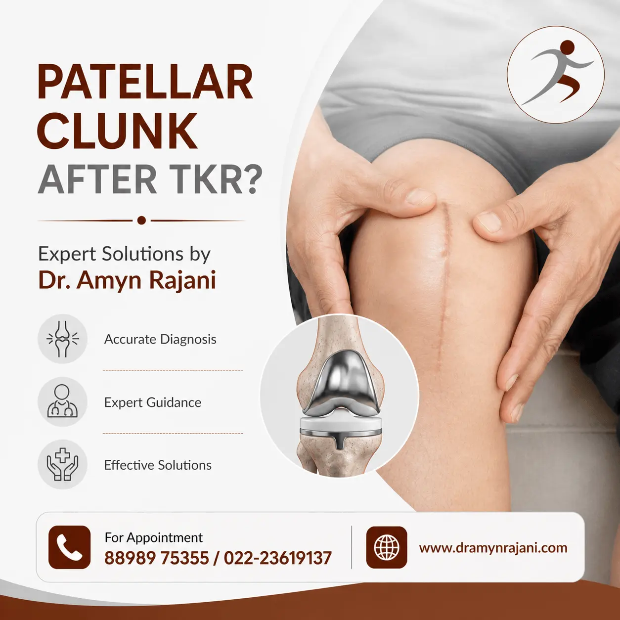 Patellar Clunk After TKR Expert Solutions by Dr. Amyn Rajani