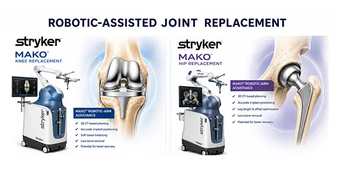 Robotic Assisted Joint Replacement Robotic Assisted Joint Replacement